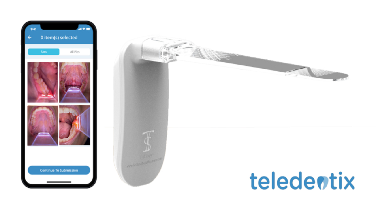 Teledentix